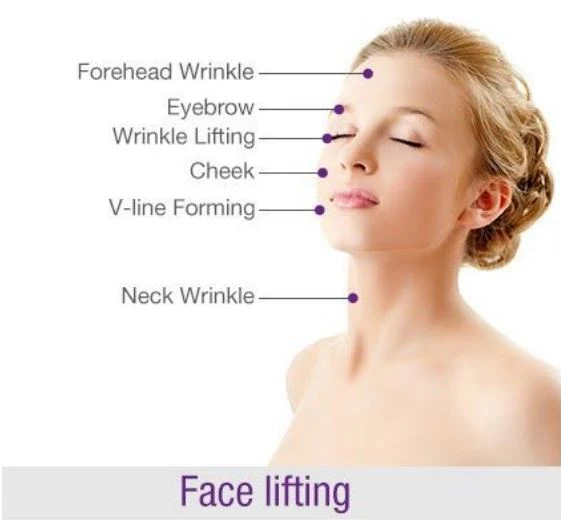 Facial treatment areas illustration