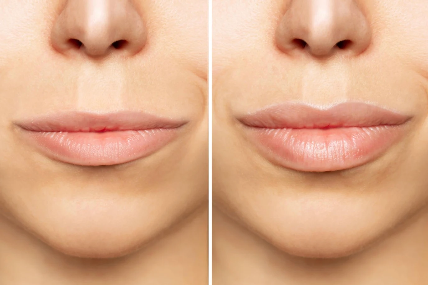 Lip volume and definition illustration