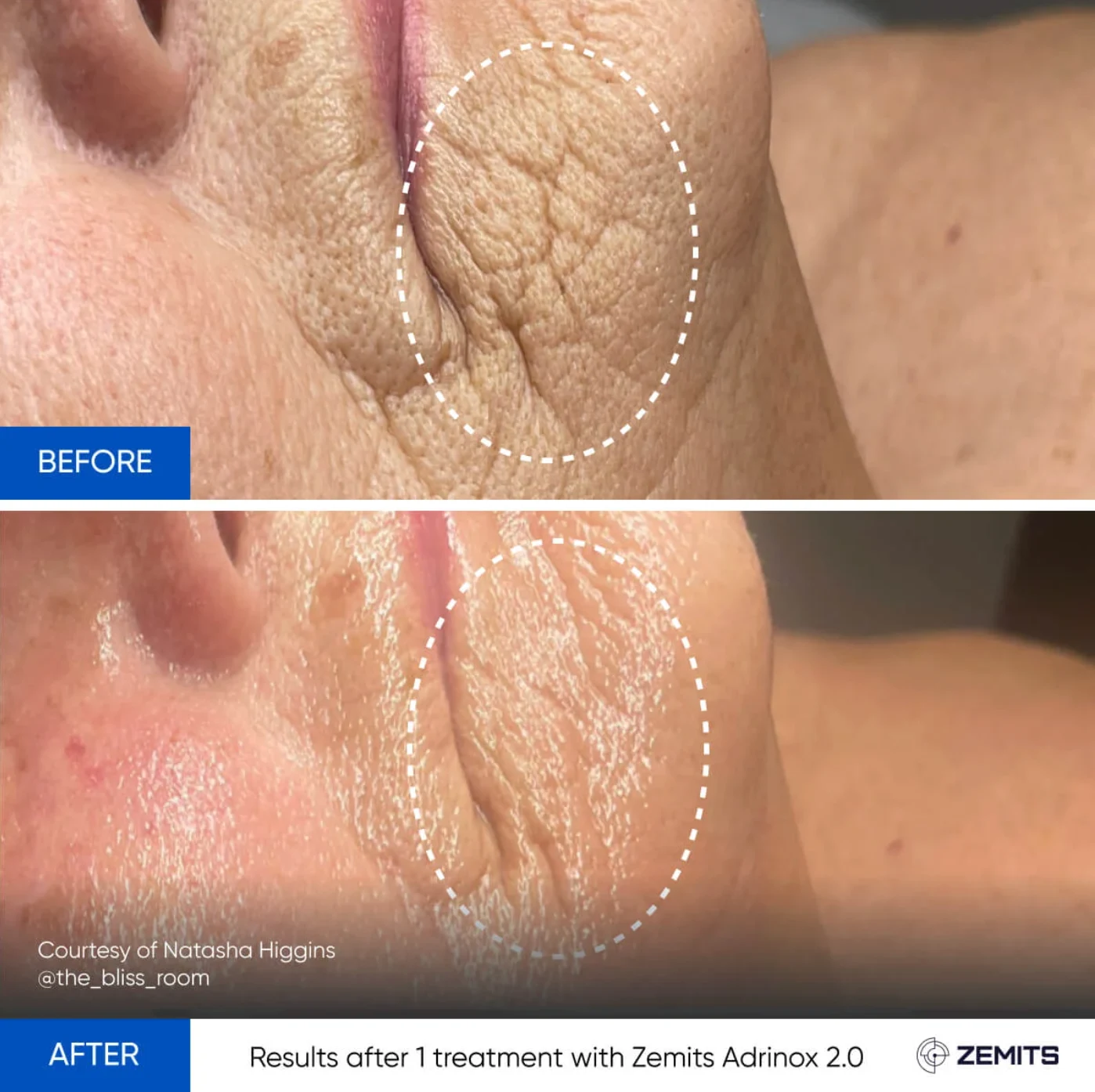 Microcurrent Facial treatment image
