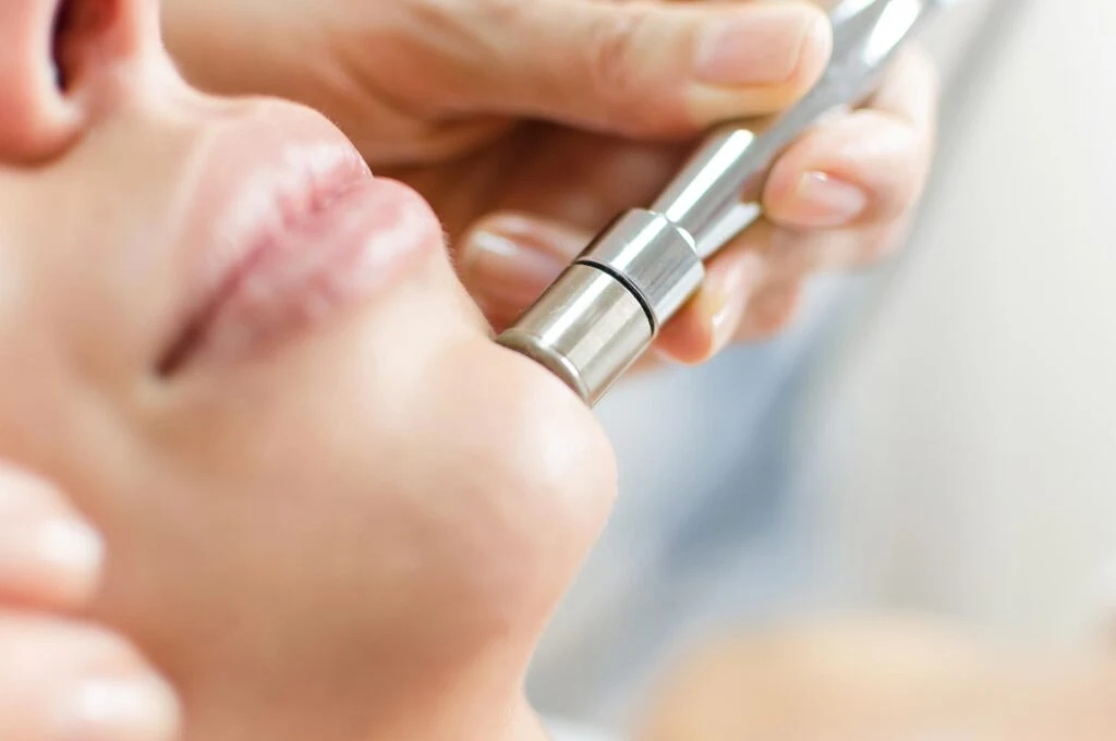 Skin resurfacing treatment photograph