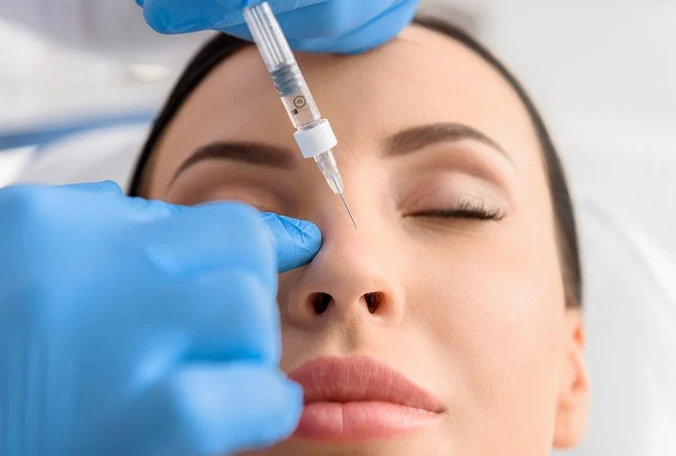 Dermal-filler procedure illustration